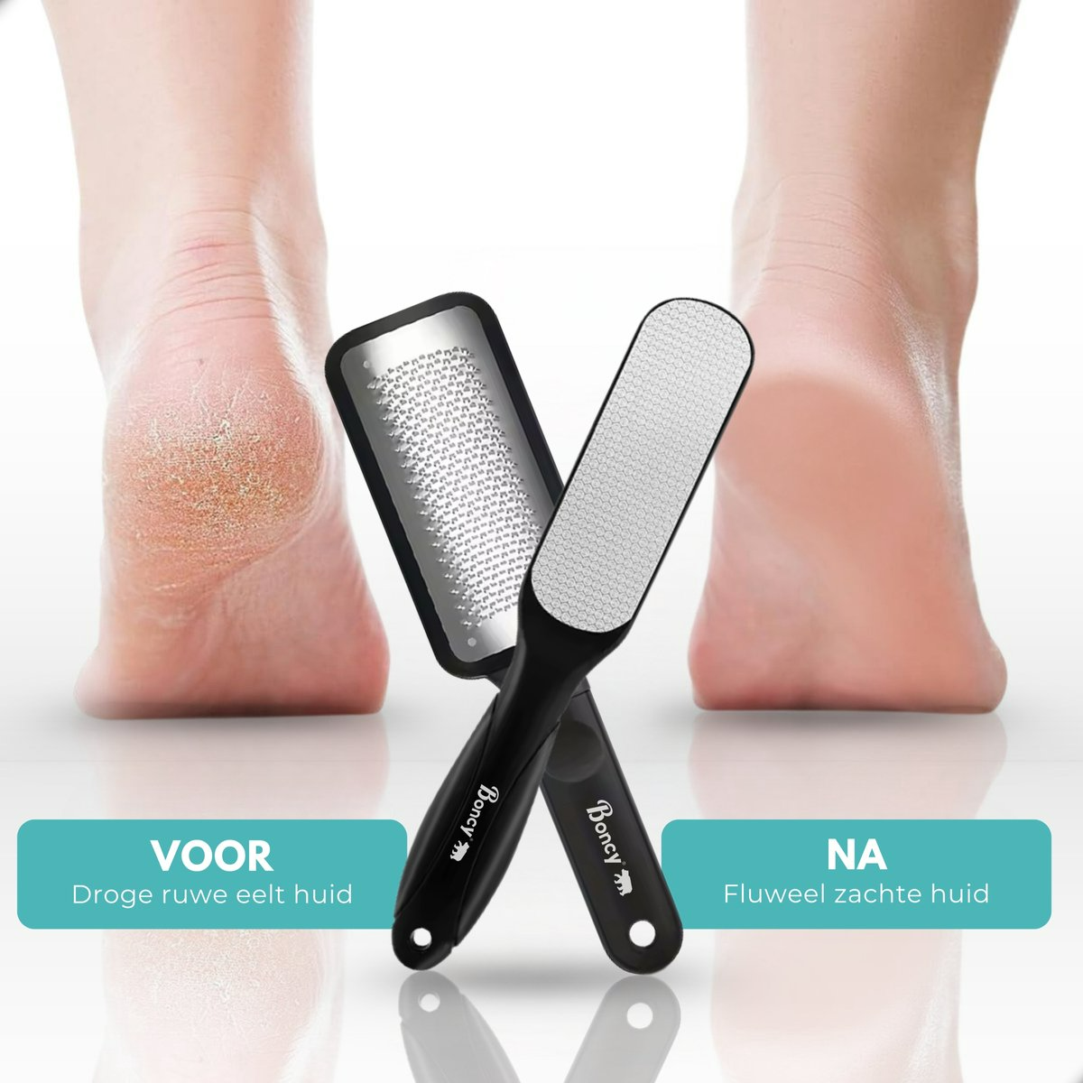 Boncy® Eeltverwijderaars 2-Pack