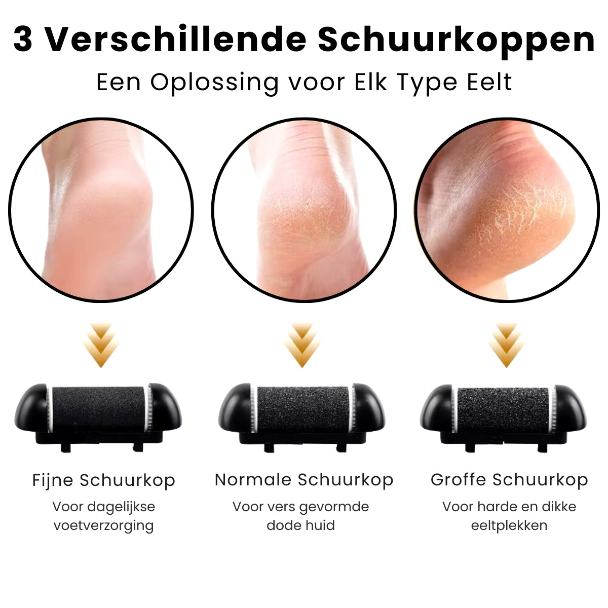 Eeltverwijderaar set