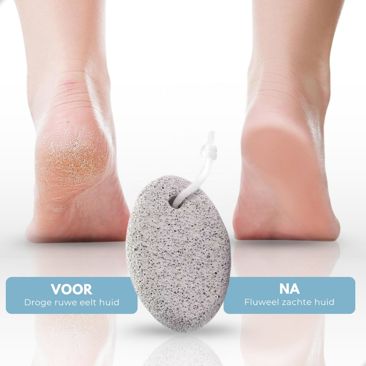 Boncy® Puimsteen Eeltverwijderaars | 2-Pack