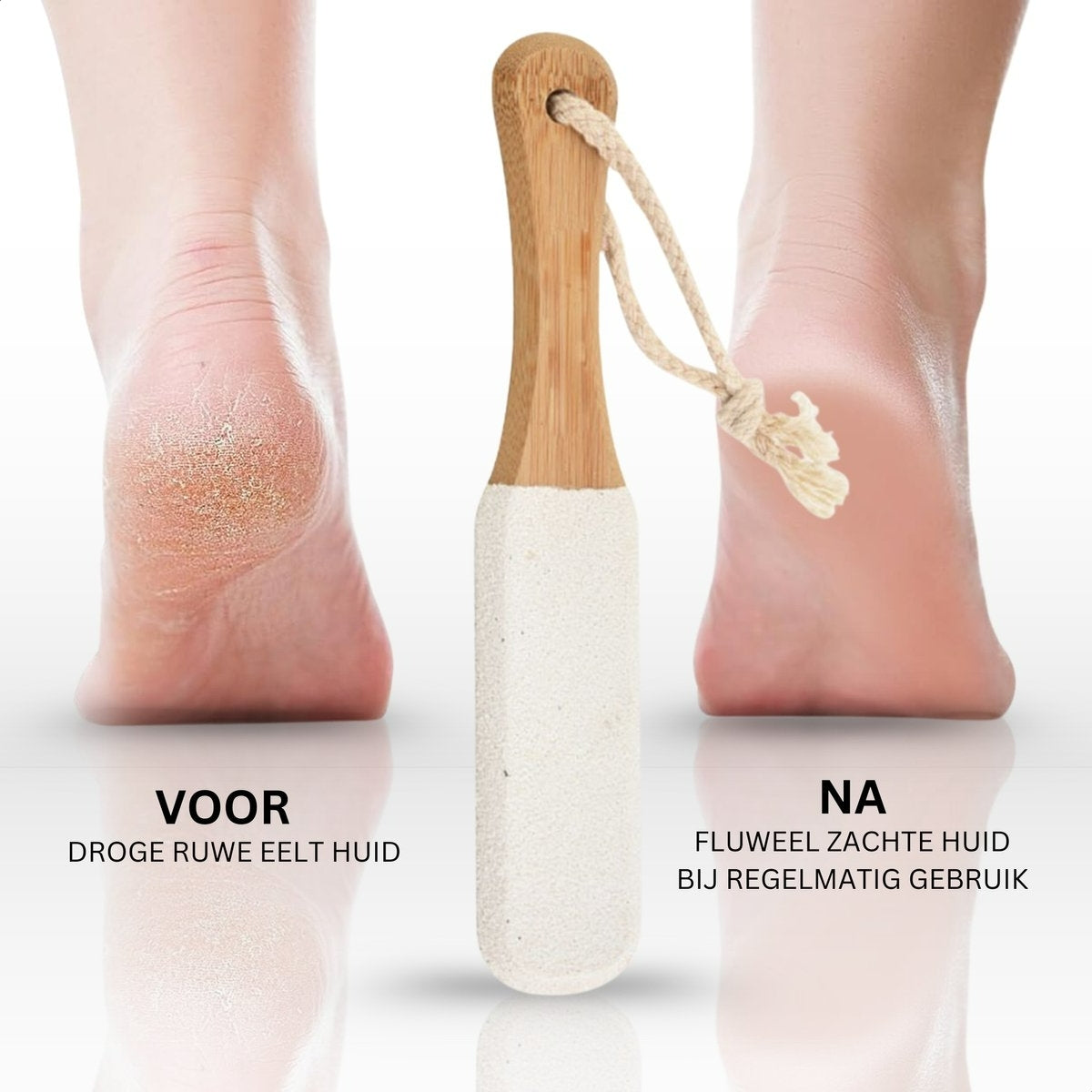 Boncy® Houten Eeltverwijderaars | 2-Pack