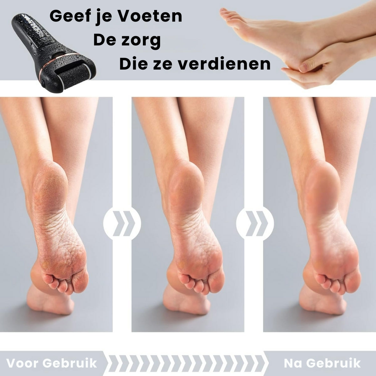 Eeltverwijderaar set