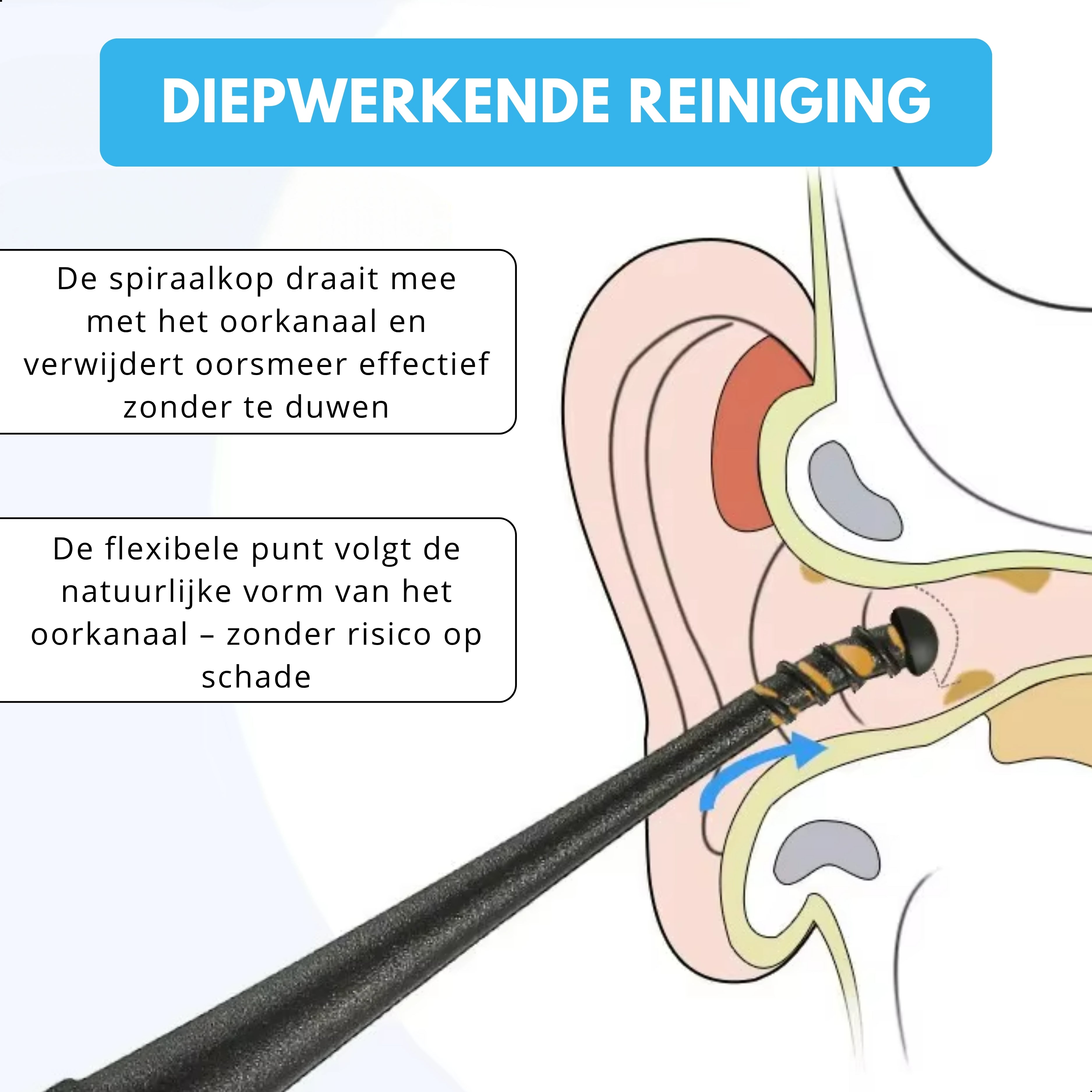 Boncy® Oorsmeer verwijderaar